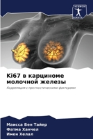 Ki67 &#1074; &#1082;&#1072;&#1088;&#1094;&#1080;&#1085;&#1086;&#1084;&#1077; &#1084;&#1086;&#1083;&#1086;&#1095;&#1085;&#1086;&#1081; &#1078;&#1077;&# 620526658X Book Cover