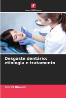 Desgaste dentário: etiologia e tratamento (Portuguese Edition) 6208396913 Book Cover