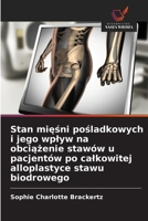 Stan miesni posladkowych i jego wplyw na obciazenie stawów u pacjentów po calkowitej alloplastyce stawu biodrowego (Polish Edition) 6202475056 Book Cover