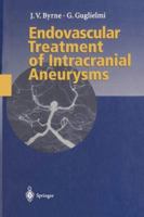 Endovascular Treatment of Intracranial Aneurysms 3642803830 Book Cover