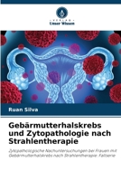 Gebärmutterhalskrebs und Zytopathologie nach Strahlentherapie (German Edition) 6207740939 Book Cover