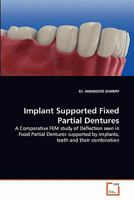 Implant Supported Fixed Partial Dentures: A Comparative FEM study of Deflection seen in Fixed Partial Dentures supported by implants, teeth and their combination 3639356497 Book Cover