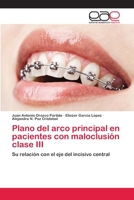 Plano del Arco Principal En Pacientes Con Maloclusion Clase III 3659070076 Book Cover