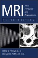 Mri: Basic Principles and Applications