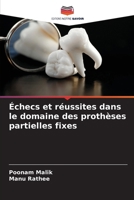 Échecs et réussites dans le domaine des prothèses partielles fixes (French Edition) 6209938051 Book Cover