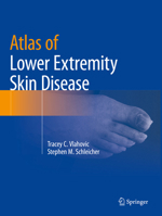 Atlas of Lower Extremity Skin Disease 3031079523 Book Cover