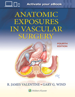 Anatomic Exposures in Vascular Surgery 197515276X Book Cover