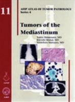 Tumors of the Mediastinum 1933477075 Book Cover