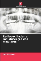 Radiopacidades e radiolucenças dos maxilares (Portuguese Edition) 6209528333 Book Cover