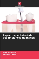 Aspectos periodontais dos implantes dentários (Portuguese Edition) 6207544153 Book Cover