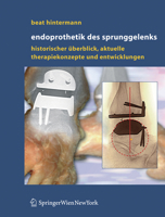Endoprothetik Des Sprunggelenks: Historischer Uberblick, Aktuelle Therapiekonzepte Und Entwicklungen 3211235868 Book Cover