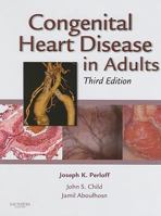 Congenital Heart Disease in Adults 141605894X Book Cover