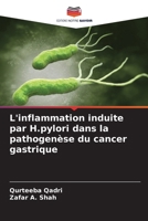L'inflammation induite par H.pylori dans la pathogenèse du cancer gastrique (French Edition) 6207991621 Book Cover