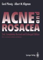 Acne and Rosacea 331949273X Book Cover