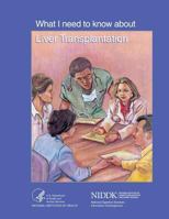 What I Need to Know about Liver Transplantation 1496089057 Book Cover