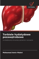 Torbiele hydatydowe pozawatrobowe (Polish Edition) 6630040899 Book Cover