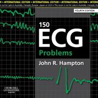 150 ECG Problems 0443068232 Book Cover