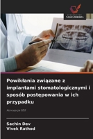 Powiklania zwiazane z implantami stomatologicznymi i sposób postepowania w ich przypadku (Polish Edition) 6630430913 Book Cover