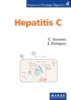 Hepatitis C (Spanish Edition) 8492442093 Book Cover