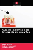 Cura de Implantes e Bio- Integração de Implantes 6203318094 Book Cover