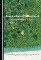 Mini Implants in Orthodontics: History, Design, and Evolution 1036417379 Book Cover