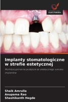 Implanty stomatologiczne w strefie estetycznej 6209107559 Book Cover