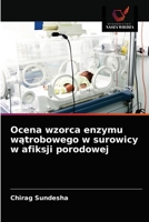 Ocena wzorca enzymu wątrobowego w surowicy w afiksji porodowej 6202950528 Book Cover