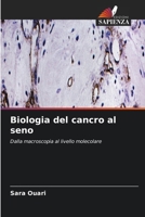 Biologia del cancro al seno (Italian Edition) 6630436059 Book Cover