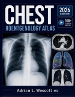 CHEST ROENTGENOLOGY ATLAS: Systematic Image Interpretation, Differential Diagnosis of Pulmonary Findings, and Evidence-Based Decision Support for Radiology Residents and Clinicians B0H7XRHLDB Book Cover
