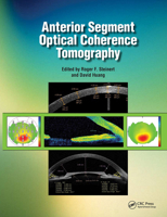 Anterior Segment Optical Coherence Tomography 1556428081 Book Cover