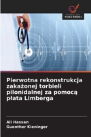 Pierwotna rekonstrukcja zakazonej torbieli pilonidalnej za pomoca plata Limberga (Polish Edition) 663003094X Book Cover