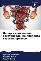 ????????????????? ... (Russian Edition) 620771153X Book Cover
