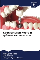 &#1050;&#1088;&#1077;&#1089;&#1090;&#1072;&#1083;&#1100;&#1085;&#1072;&#1103; &#1082;&#1086;&#1089;&#1090;&#1100; &#1080; &#1079;&#1091;&#1073;&#1085; 6205368900 Book Cover