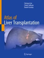 Atlas of Liver Transplantation 303185263X Book Cover