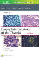 Biopsy Interpretation of the Thyroid 1975263715 Book Cover