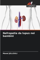 Nefropatia da lupus nei bambini 620587086X Book Cover