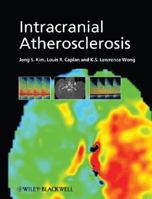 Intracranial Atherosclerosis 1405178221 Book Cover