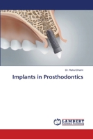 Implants in Prosthodontics 6207640527 Book Cover