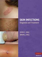 Skin Infections: Diagnosis and Treatment 0521897297 Book Cover