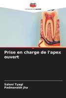 Prise en charge de l'apex ouvert (French Edition) 6207673336 Book Cover