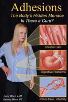 Adhesions: The Body's Inner Menace - Is There a Cure? 1986094782 Book Cover