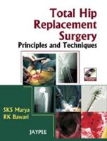 Total Hip Replacement Surgery: Principles and Techniques 818448884X Book Cover