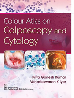 Colour Atlas on Colposcopy and Cytology 9389688604 Book Cover