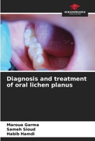 Diagnosis and treatment of oral lichen planus 6208259789 Book Cover