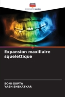 Expansion maxillaire squelettique (French Edition) 6209718353 Book Cover