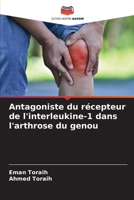 Antagoniste du récepteur de l'interleukine-1 dans l'arthrose du genou 6209621430 Book Cover