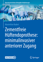 Zementfreie Hüftendoprothese: minimalinvasiver anteriorer Zugang (Operationstechniken Orthopädie Unfallchirurgie) (German Edition) 3662598906 Book Cover
