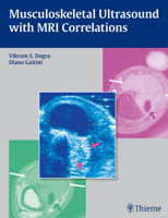 Musculoskeletal Ultrasound with MRI Correlations 1604062444 Book Cover