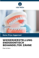 WIEDERHERSTELLUNG ENDODONTISCH BEHANDELTER ZÄHNE: Post & Kern (German Edition) B0CL6CRKTN Book Cover