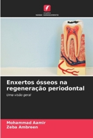 Enxertos ósseos na regeneração periodontal (Portuguese Edition) 6208634601 Book Cover